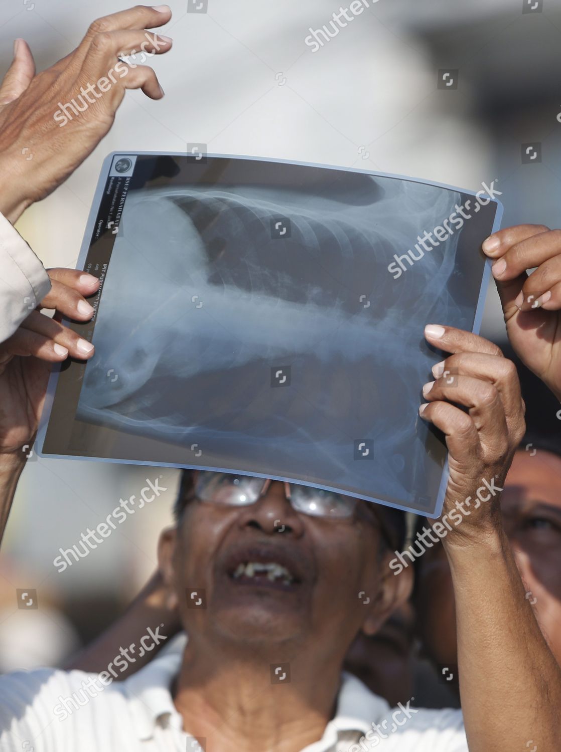 X Ray Film for Solar Eclipse 