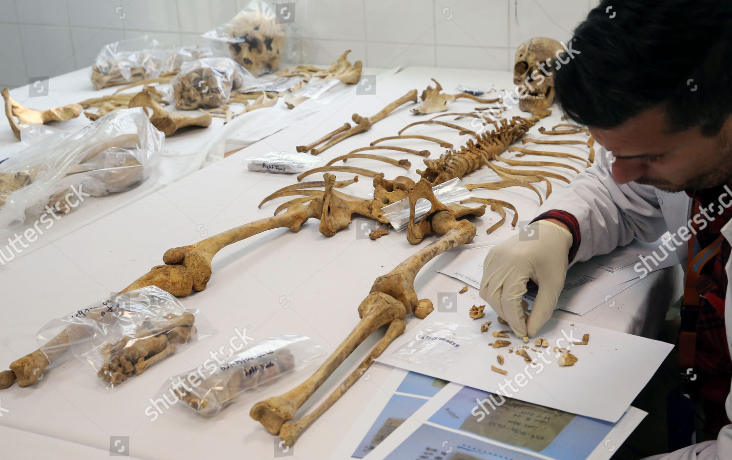 Forensic Scientist Examines Human Remains Forensics Editorial Stock ...