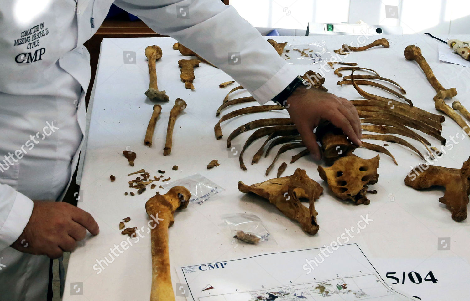 Forensic Scientist Examines Human Remains Forensics Editorial Stock