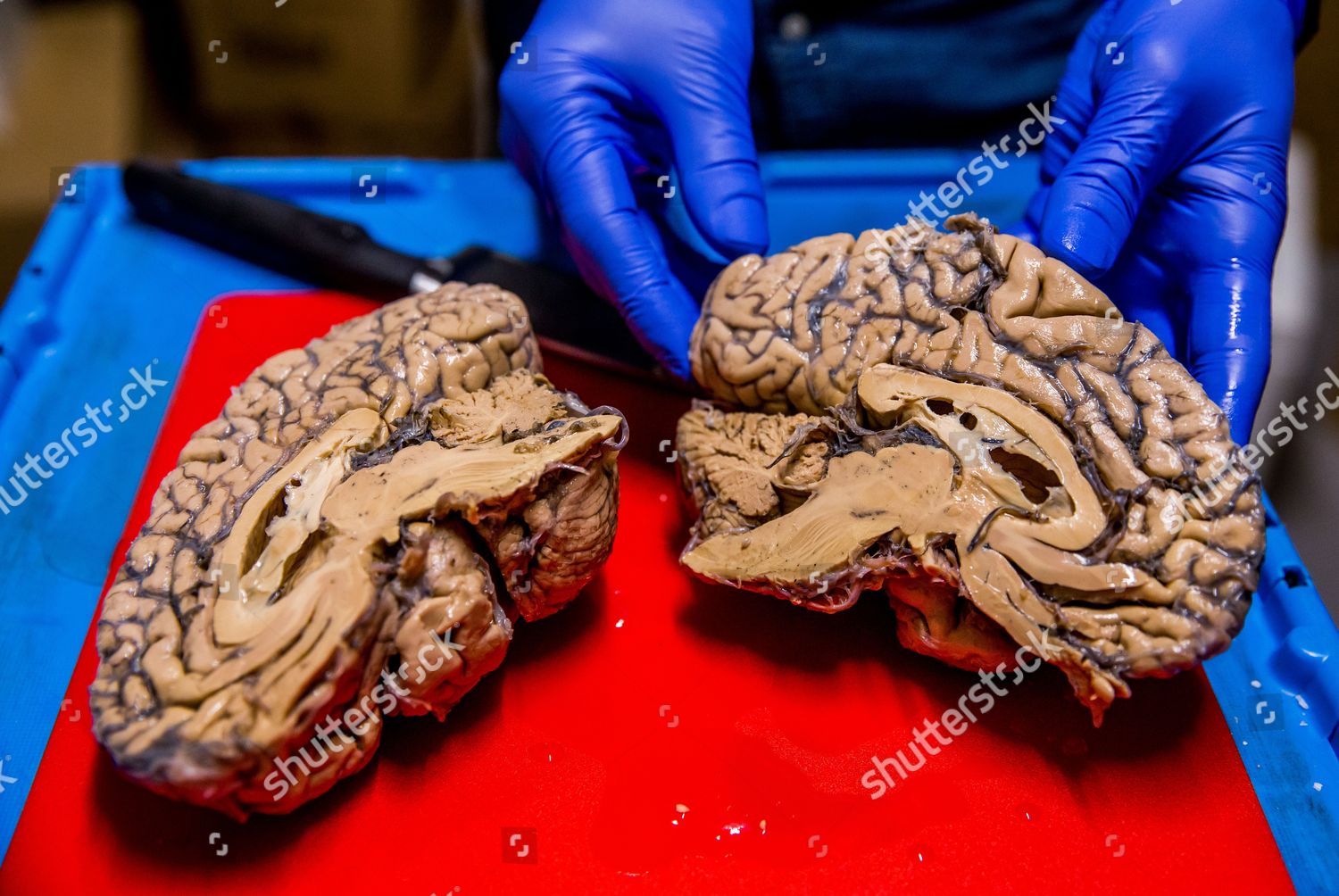 Researcher Shows Human Brain Cut Half Duffel Editorial Stock Photo Stock Image Shutterstock