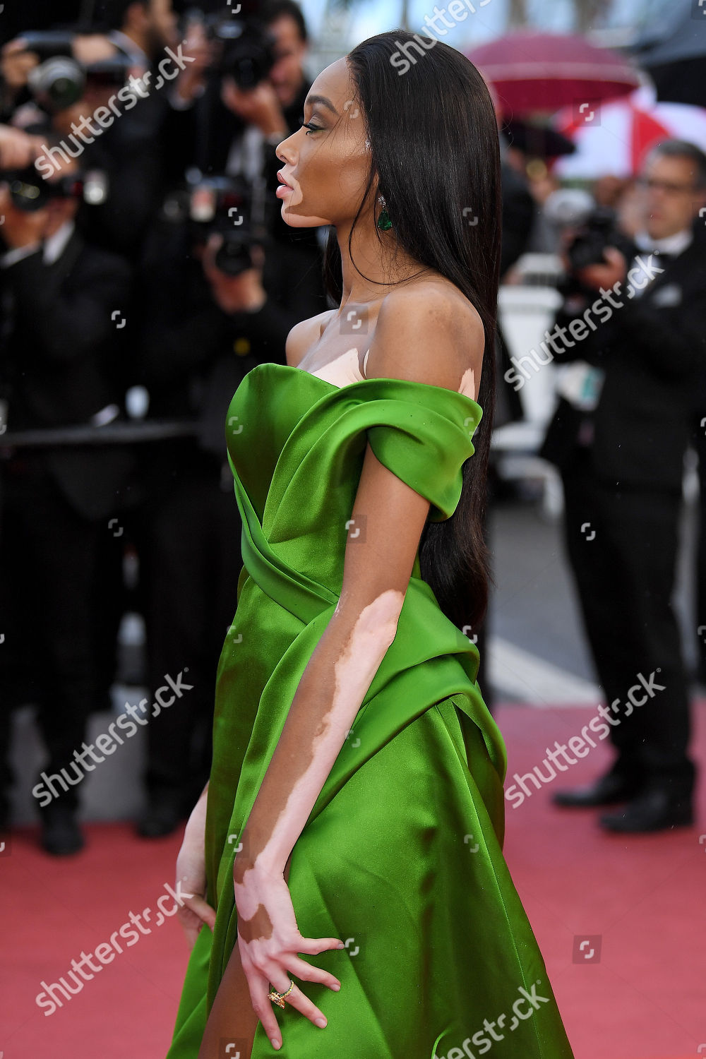 Winnie Harlow Editorial Stock Photo - Stock Image | Shutterstock