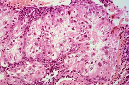 Arias Stella Stock Pictures, Editorial Images and Stock Photos